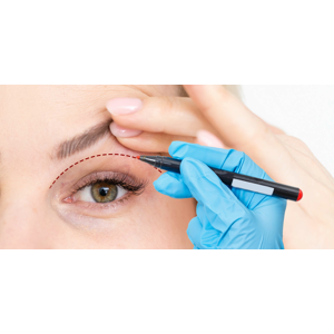 Blefaroplastika – korekcia očných viečok pre mladší a svieži vzhľad