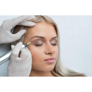 Fibroblast - nechirurgický lifting očného okolia alebo odstránenie vrások okolo očí, úst či na čele